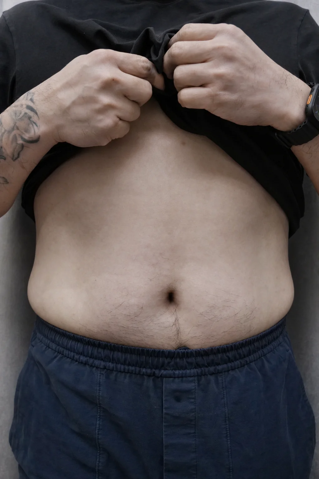Before — Perut D.P.